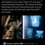 Boy Dies After Swallowing Groundnut as Hospital Fails to Provide Tracheostomy Tube